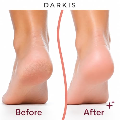 Electric Foot Callus Remover – Rechargeable Pedicure Tool