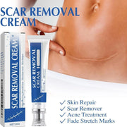 SilkRenew Scar Gel