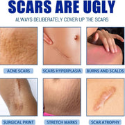 SilkRenew Scar Gel