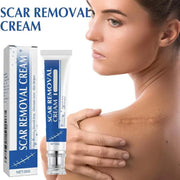 SilkRenew Scar Gel